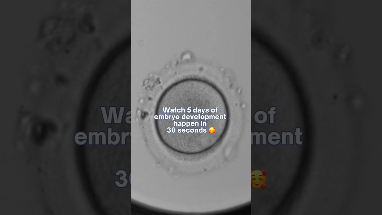 5 days of embryo development in 30 seconds! 😍 #ivf #biology #wantababy