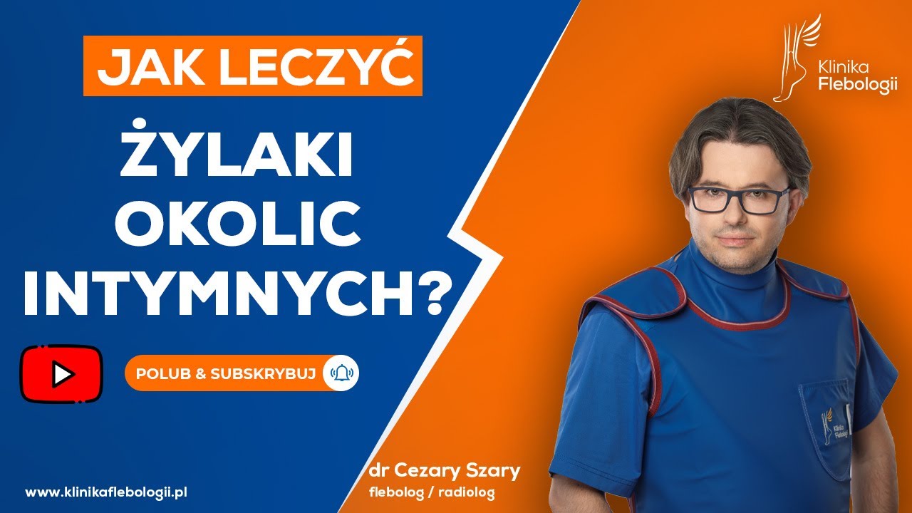 Żylaki okolic intymnych - jak je leczyć?