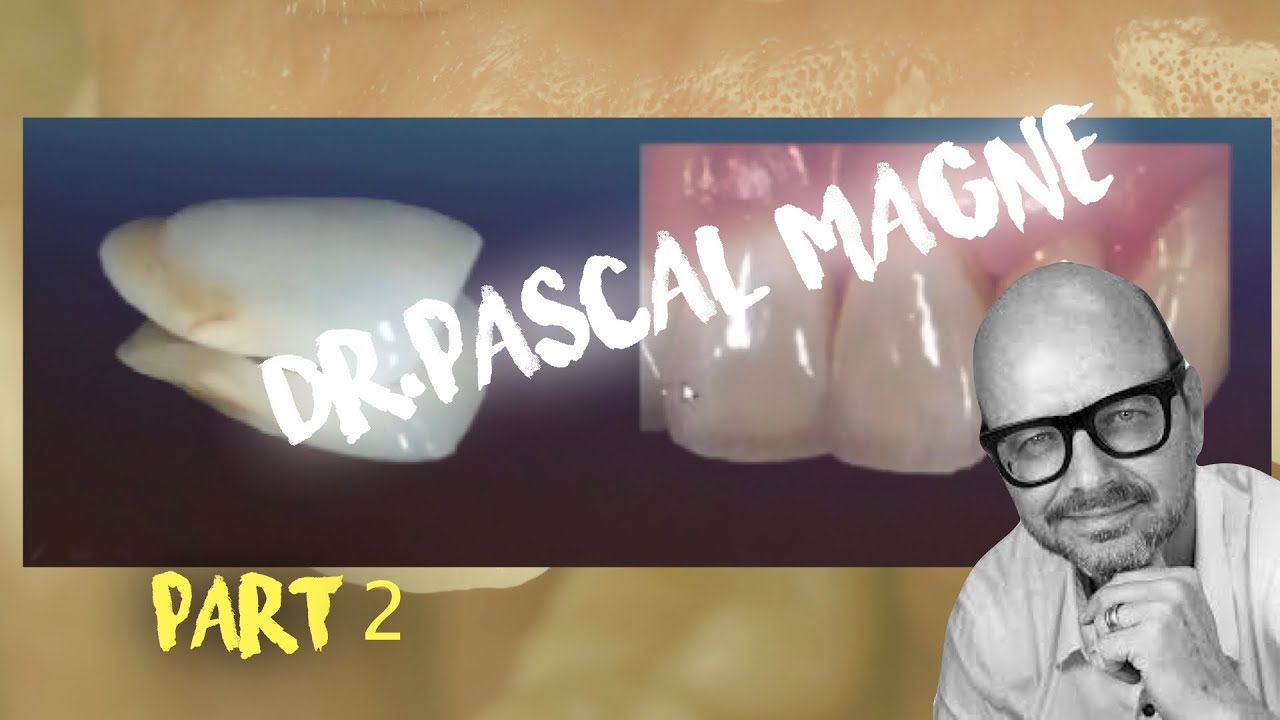 Pascal Magne Part #2