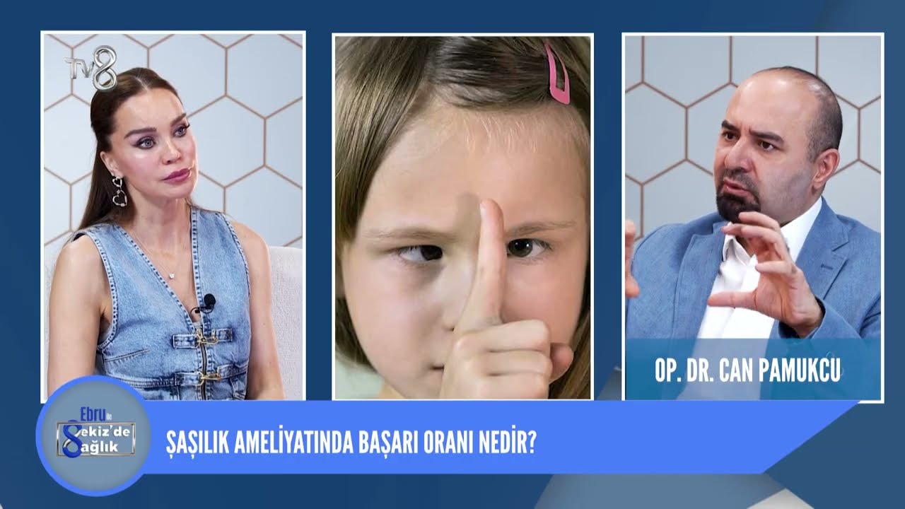 Göz kayması yani şaşılık hakkında merak ettikleriniz 