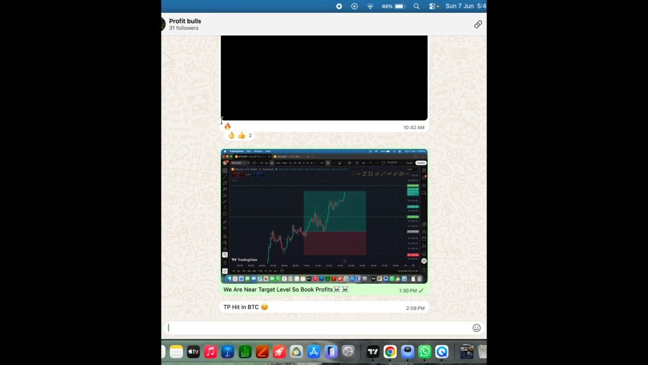 🔥 XAUUSD Analysis Today | High Probability Trade Setups #trading #shorts #explore #profitbulls