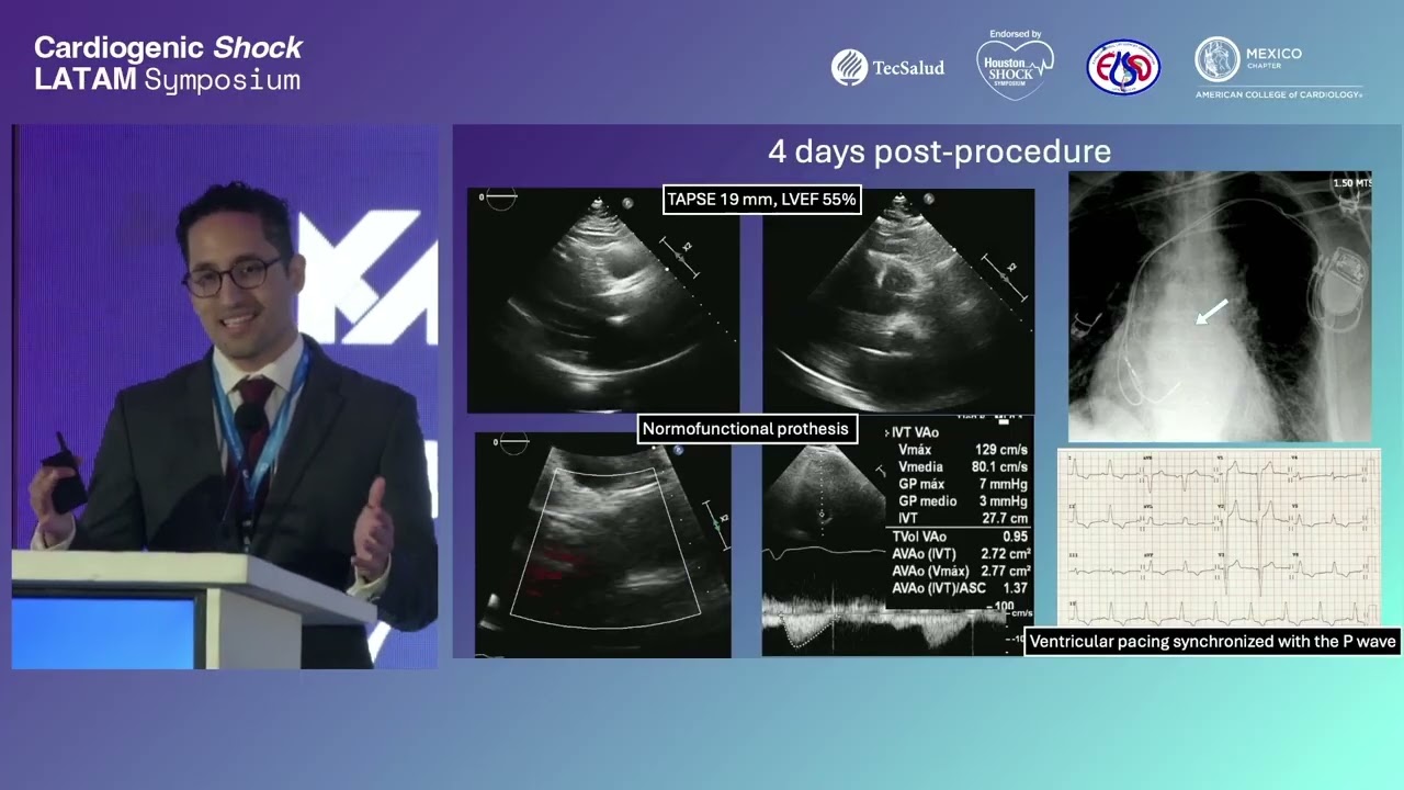 Session 4 Valvular Shock