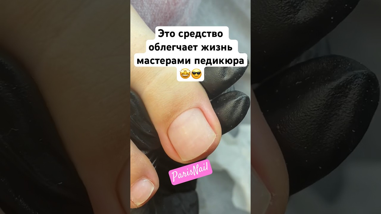 Помощник для мастера педикюра &mdash; жидкий кератолитик ParisNail✨ Арт. на ОЗОН: 1054049799 #ногти #стопы