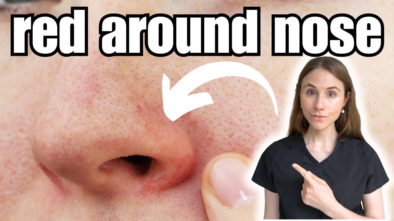 Skincare For Redness Around Nose | Dermatologist Tips