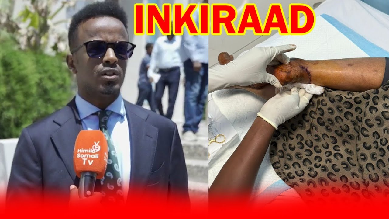 DEGDEG :- Wasiir Dowlada Gaashaandhiga oo inkiray dhaawaca Xil. Cadar Xareed.