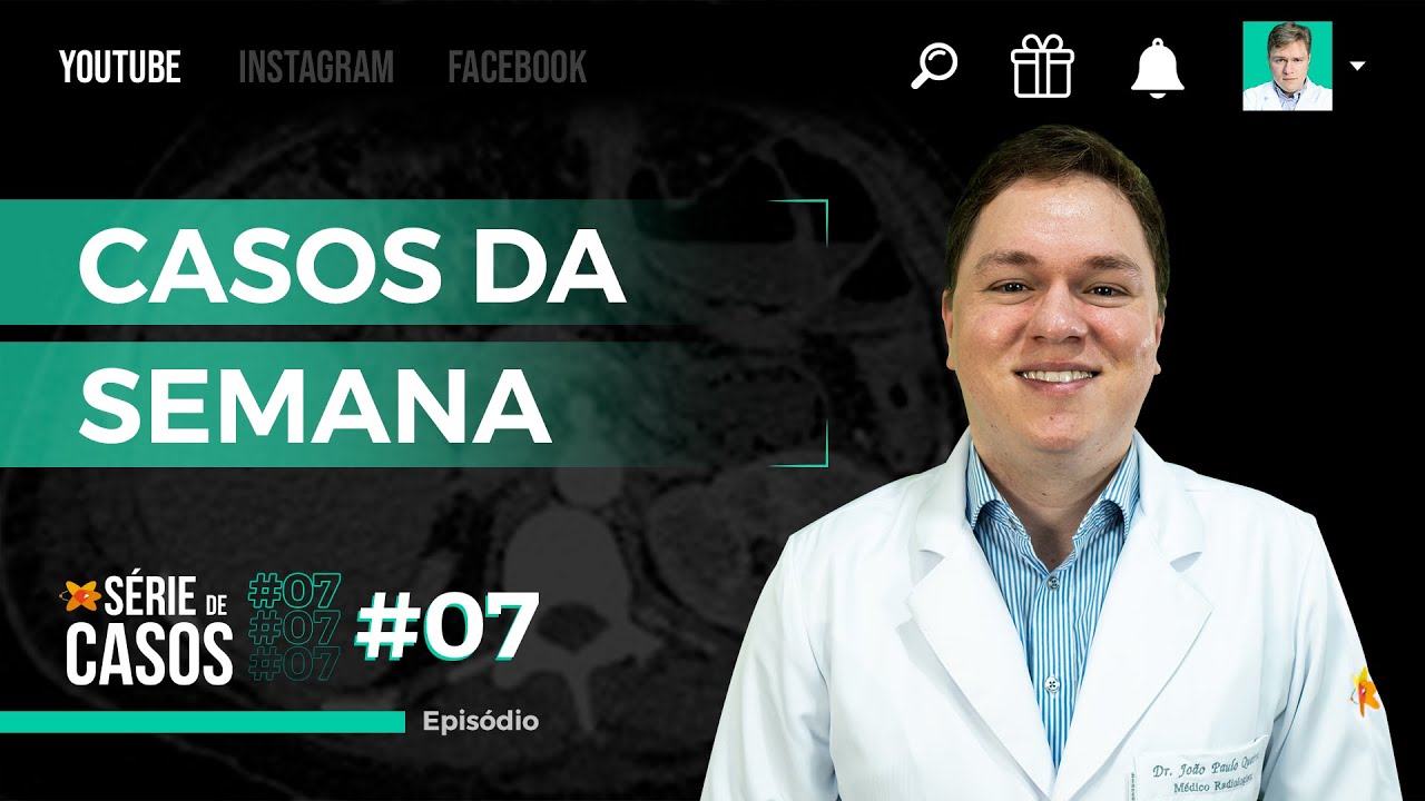 CASOS DA SEMANA #7