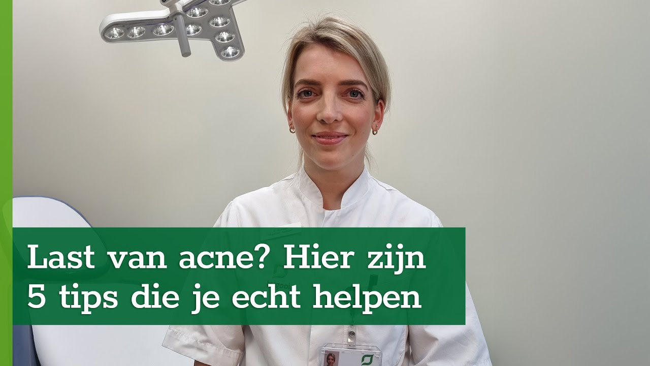 5 Tips bij Acne