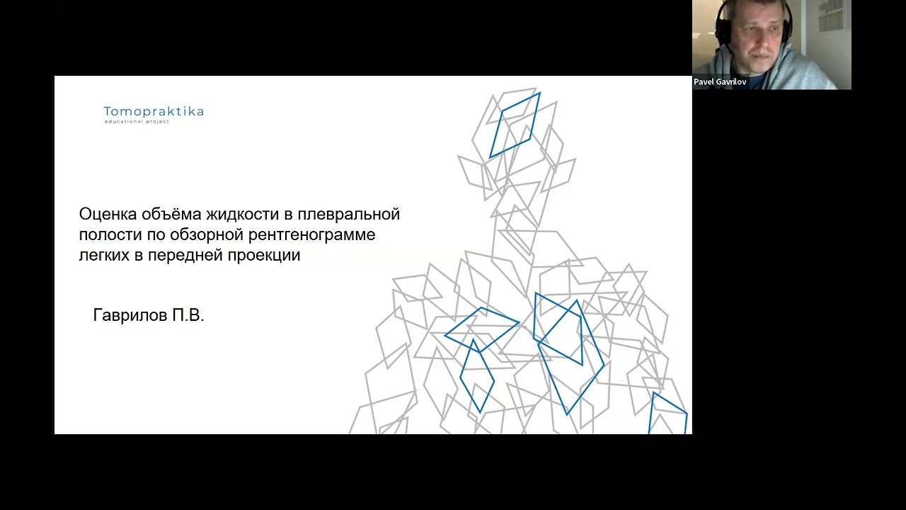Оценка объёма жидкости в плевральной полости по обзорной рентгенограмме легких в передней проекции