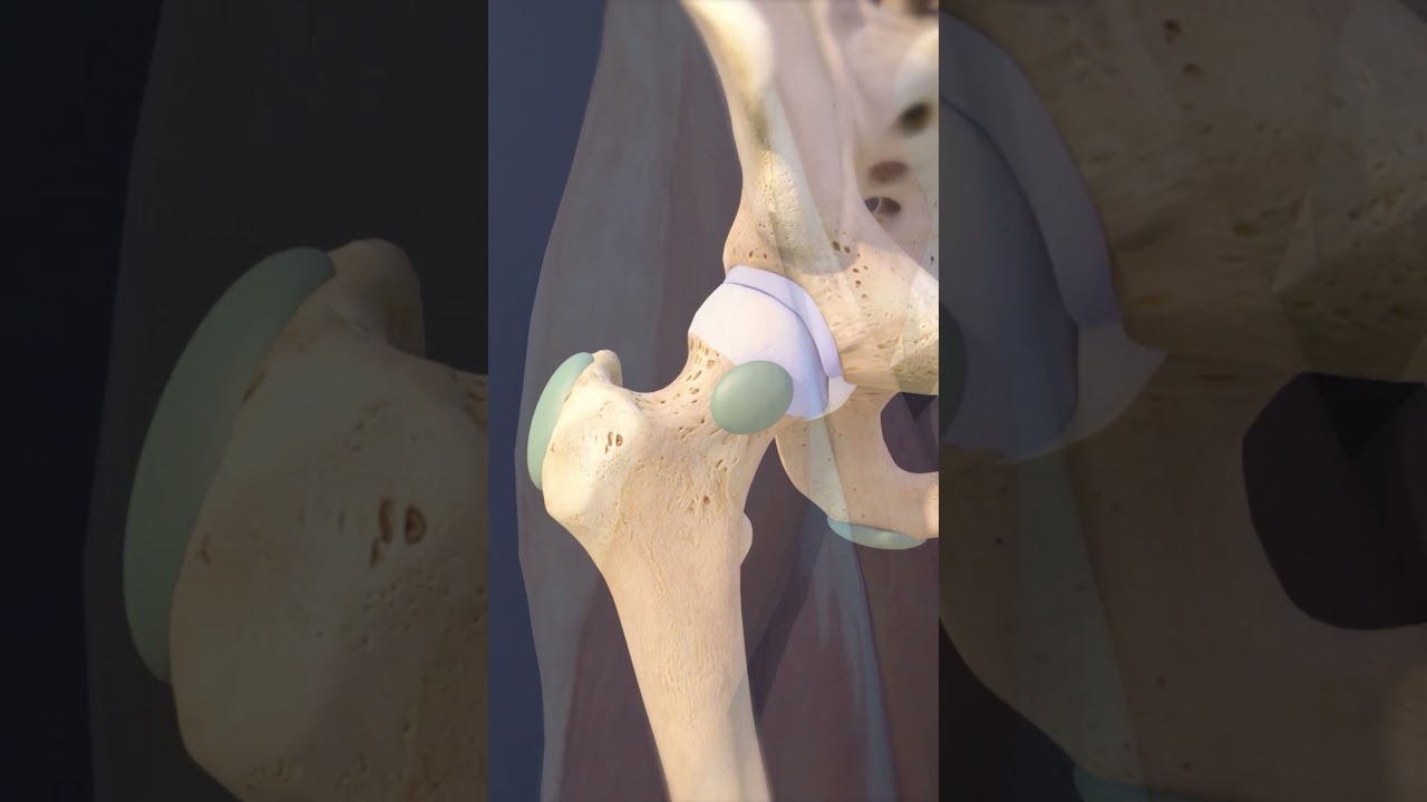 Hip Bursa & Impingement Explained