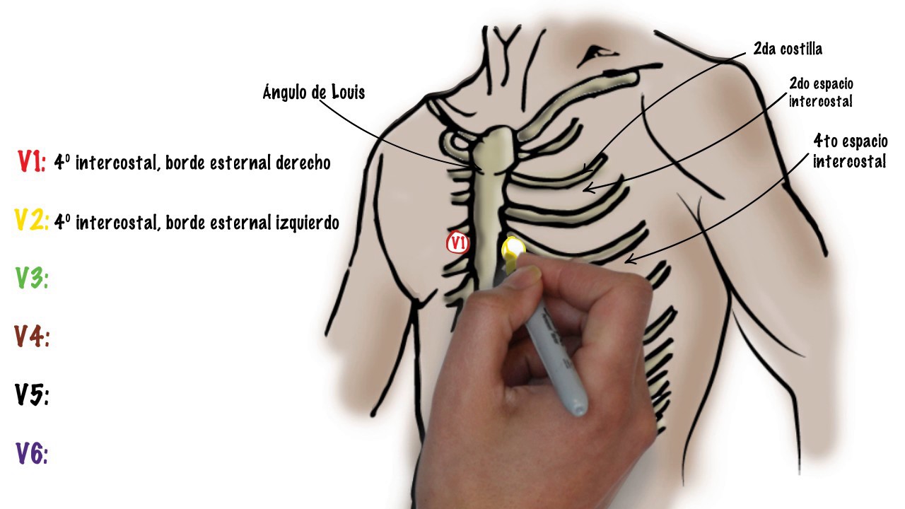 Como hacer un ECG electrocardiograma