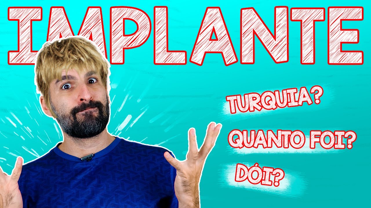 MEU IMPLANTE CAPILAR - Quanto custa? Dói? Aqui ou na Turquia? Carro Chefe responde