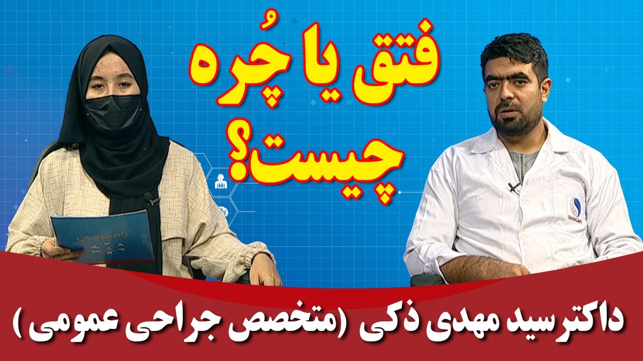 راه درمان: فتق یا چُره چیست؟ - داکتر سید مهدی ذکی (متخصص جراحی عمومی)