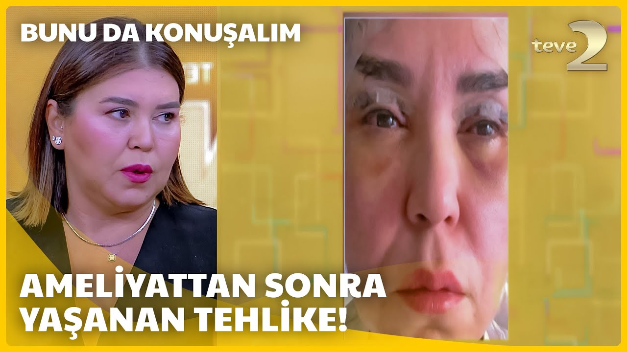 teve2'de Bunu da Konuşalım | Az kalsın gözlerini kaybediyordu! 😧