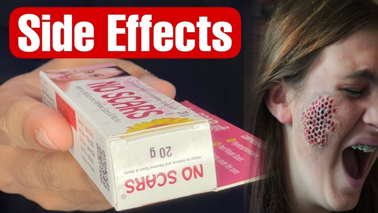 No scars cream | Review use | kaise Band kare | no scars cream side effects solution | Onlyone