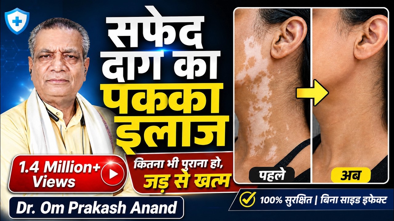 सफेद दाग कितना भी पुराना हो जड़ से हो सकता है ठीक || Dr. Om prakesh anand