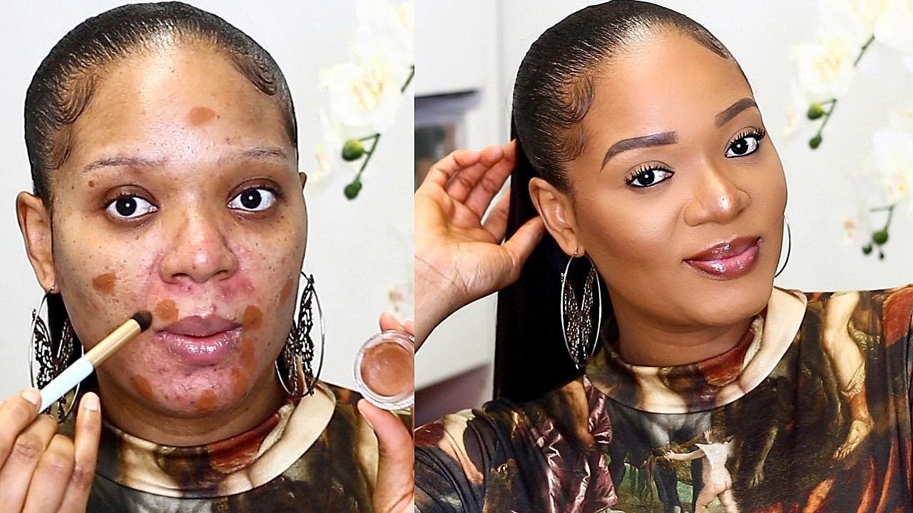IMPERFECT SKIN 