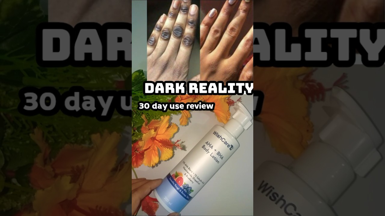 30day use review | wishcare AHA + BHA body lotion #shortsfeed #lotion #shorts #exfoliate #skincare