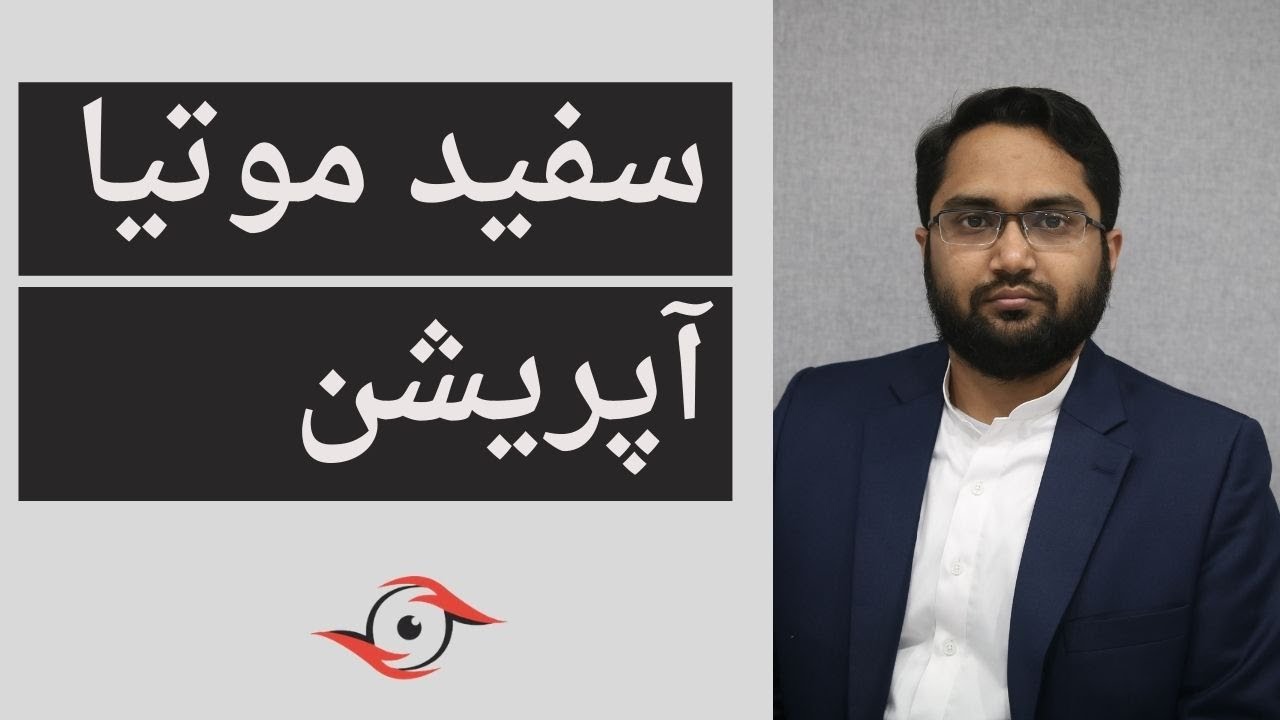 Safed Motia Cataract Laser Operation/Phacoemulsification k doran kya hota hai/ Steps ? Urdu / Hindi