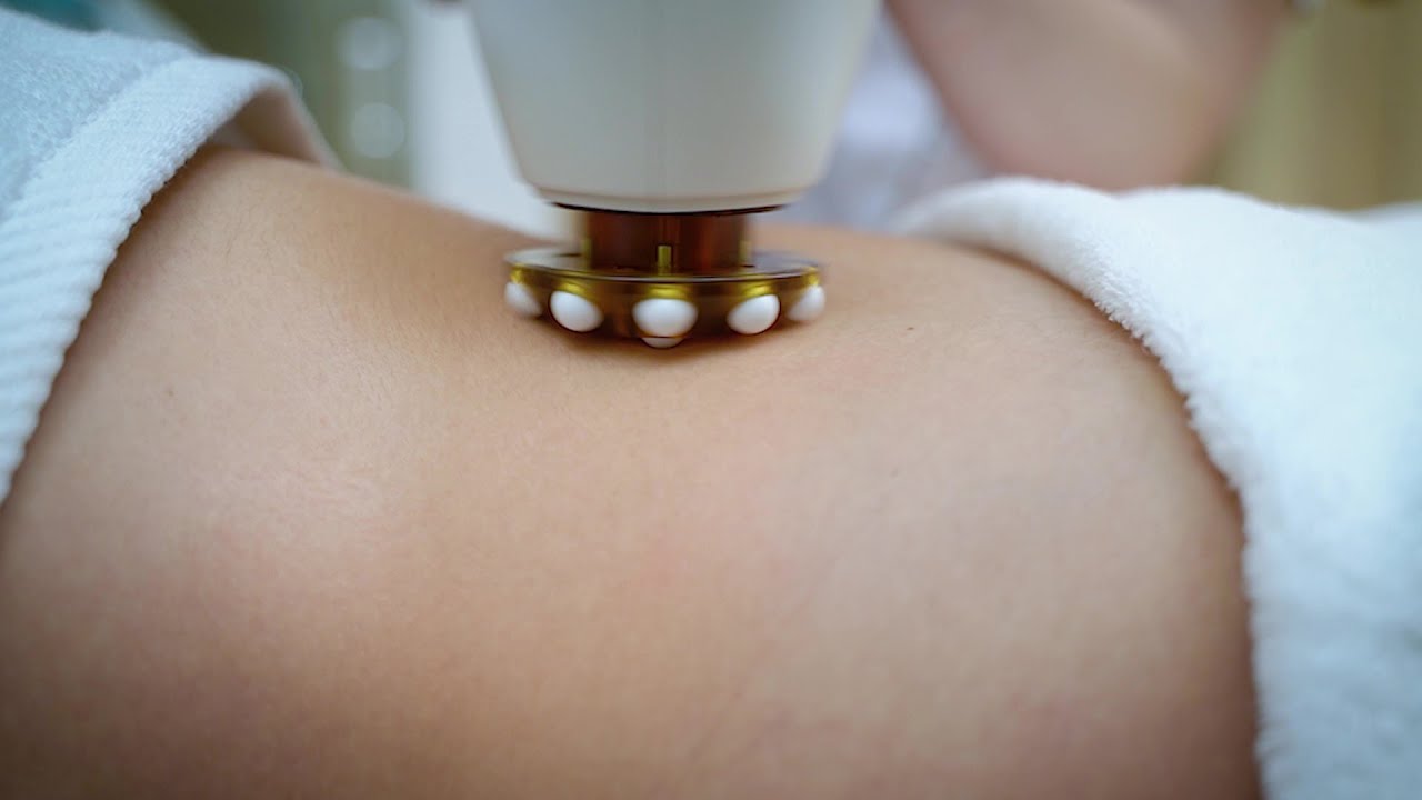 Ujędrnienie sk&oacute;ry twarzy i ciała Alma SpaDeep w Ambra Day SPA