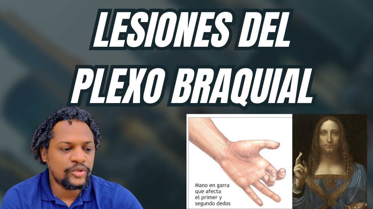 LESIONES MÁS COMUNES DEL PLEXO BRAQUIAL PARTE 2