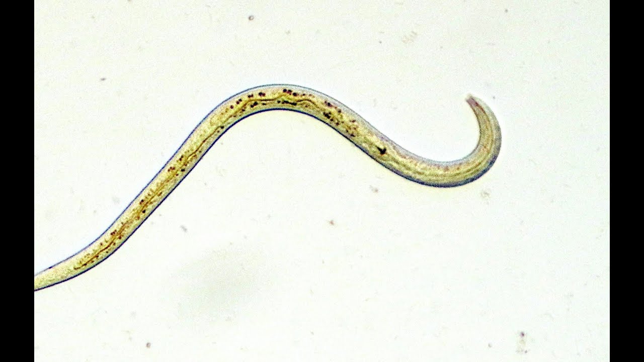 NEMATODOS fitopatogenos: Generalidades (biolog&iacute;a y descripci&oacute;n del da&ntilde;o)