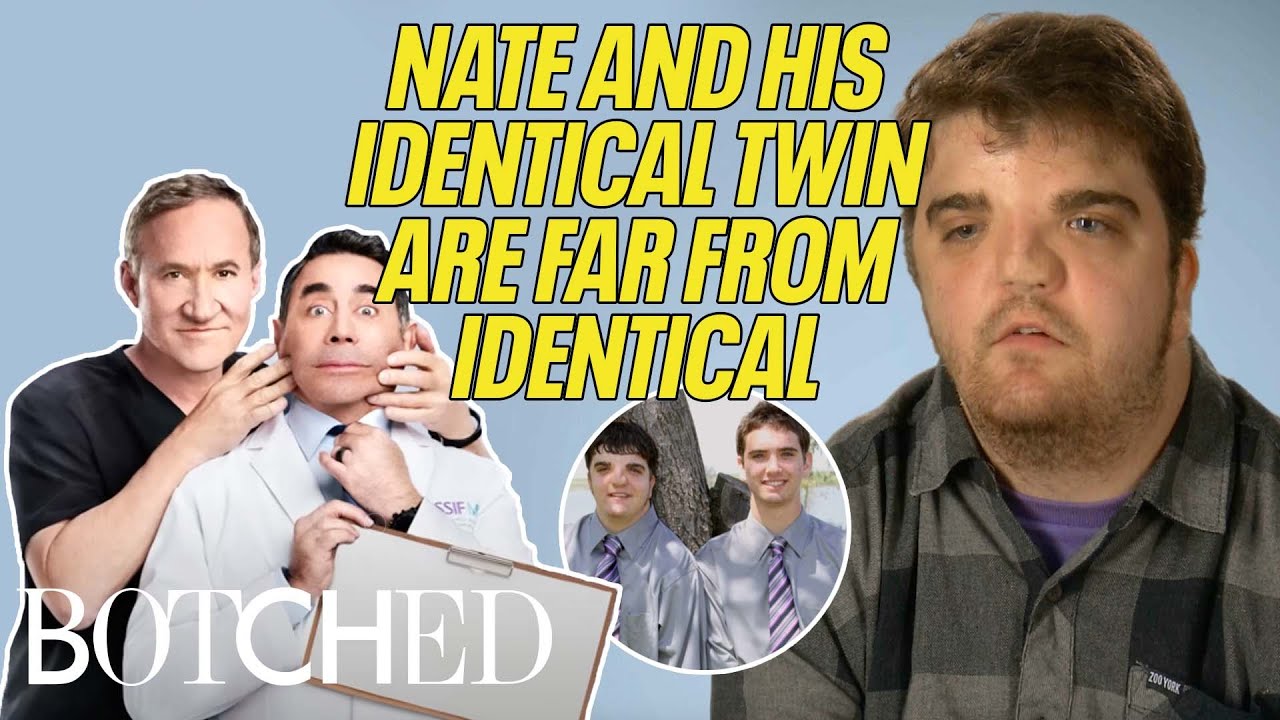 Doctors Help Nate Look More Identical to His Identical Twin (Botched By Nature) | Botched | E!