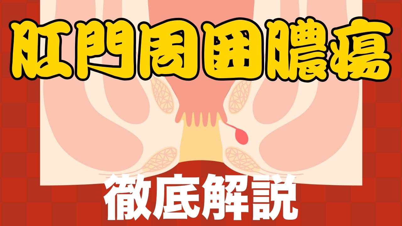 【激痛・発熱に注意】肛門周囲膿瘍とは？症状・検査・切開排膿まで院長が徹底解説｜くるめ病院
