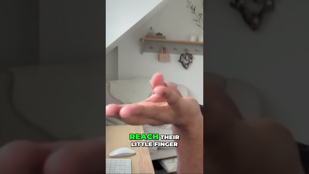 Can Severe Carpal Tunnel Syndrome Limit Thumb Movement? 🤔✋