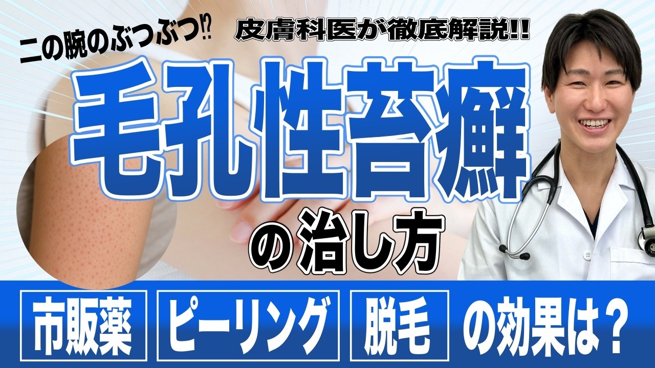 皮膚科医が語る二の腕ブツブツ！それ毛孔性苔癬かも！？治療法から自宅のケア・原因なども解説！