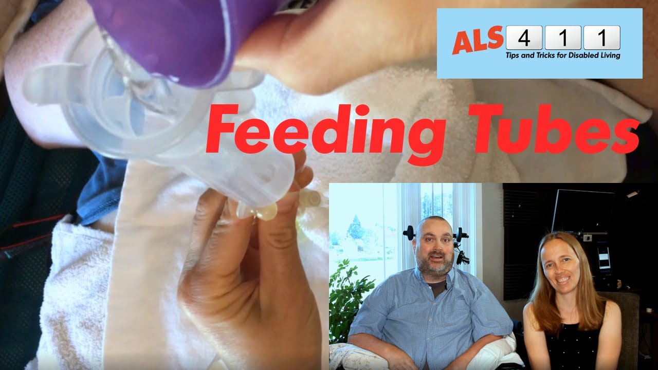 My Experience Getting a Feeding Tube, and Care (but Not Feeding)