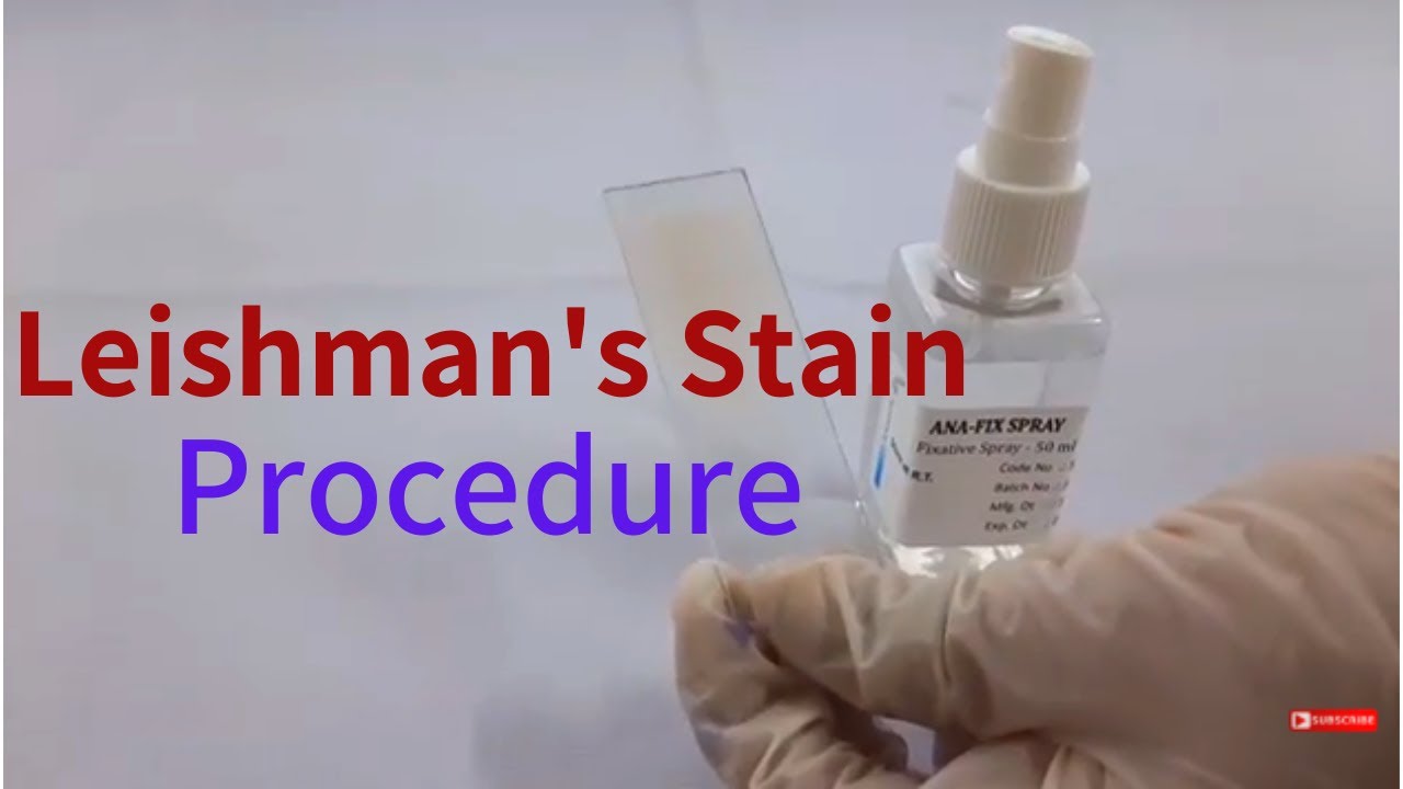 Leishman's Stain Procedure-In English