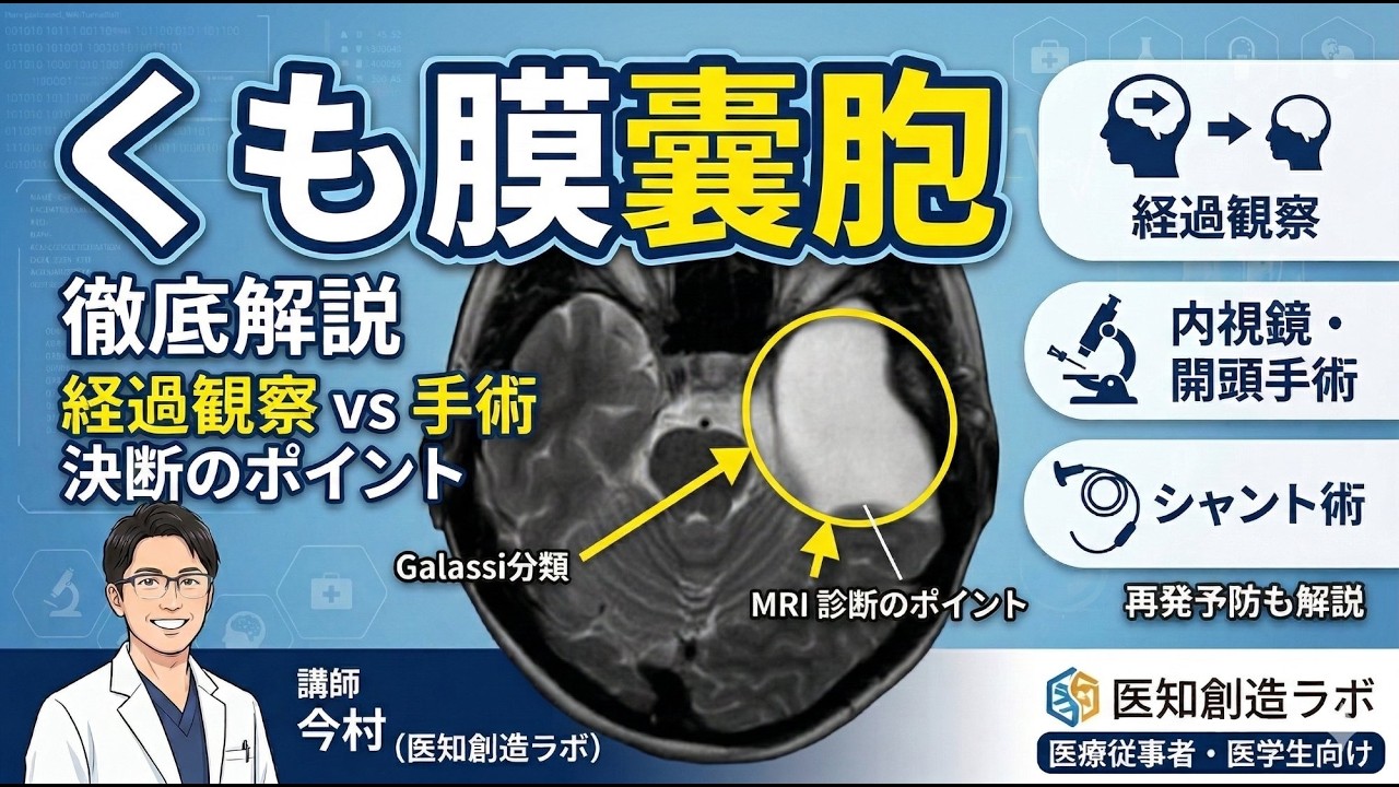 くも膜嚢胞の詳しい解説動画