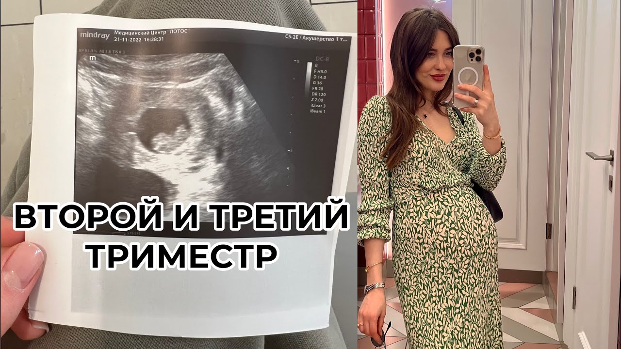 ВЕЩИ ДЛЯ МЛАДЕНЦА| МОЙ ВТОРОЙ И ТРЕТИЙ ТРИМЕСТР БЕРЕМЕННОСТИ