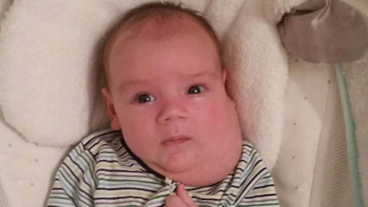 Baby Goes Under the Knife To Remove Football-Sized Mass From His Face