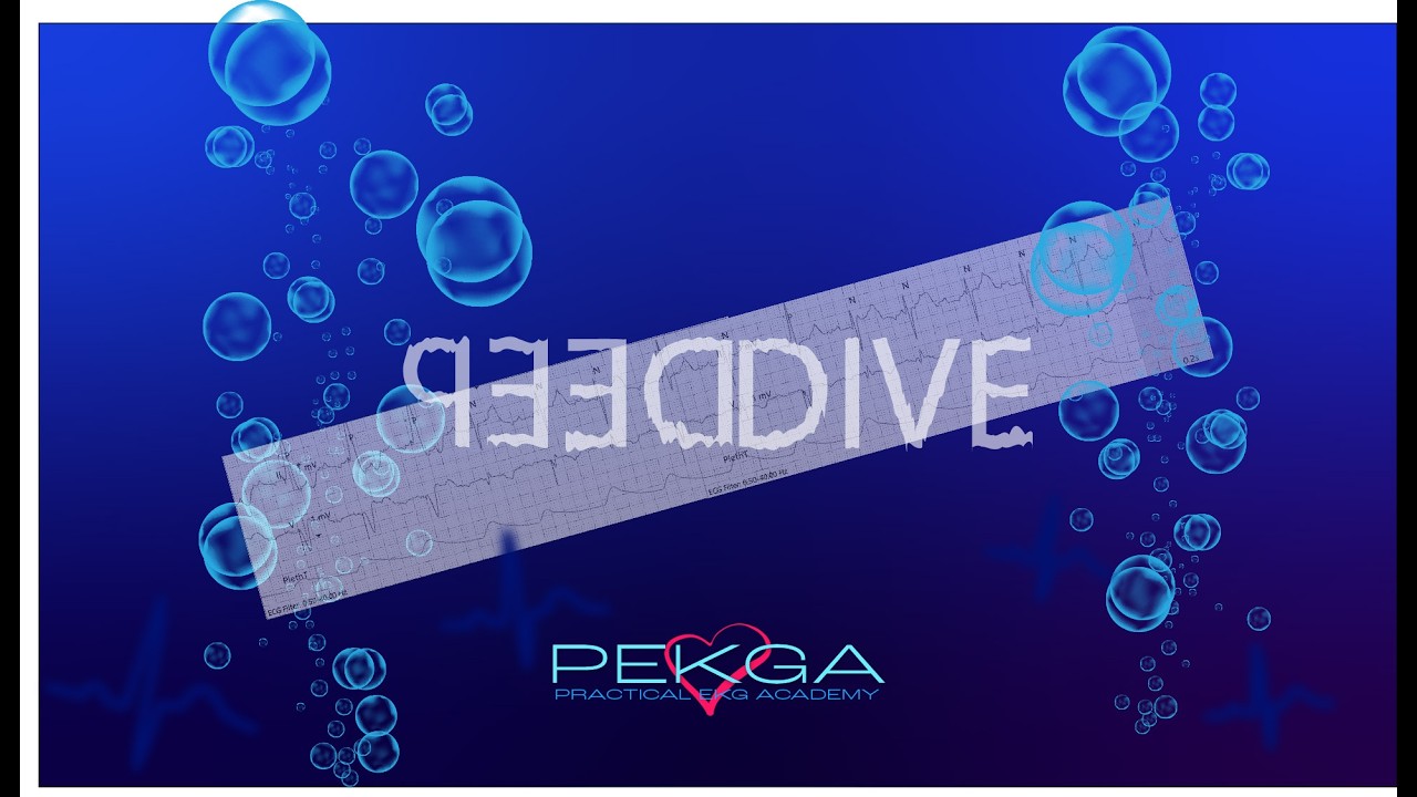 PACEMAKER AND ATRIAL FLUTTER - DEEP-DIVE - PEKGA