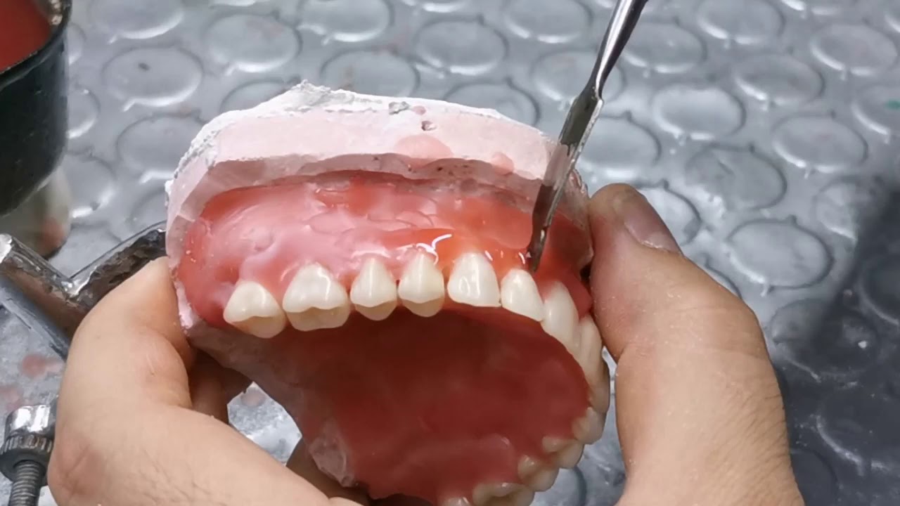 Enfilado de dientes