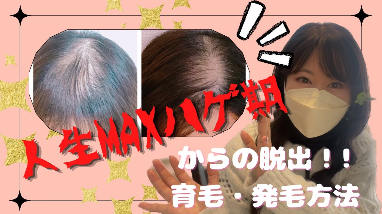 薄毛脱出！！2年半取り組んできた育毛・発毛方法