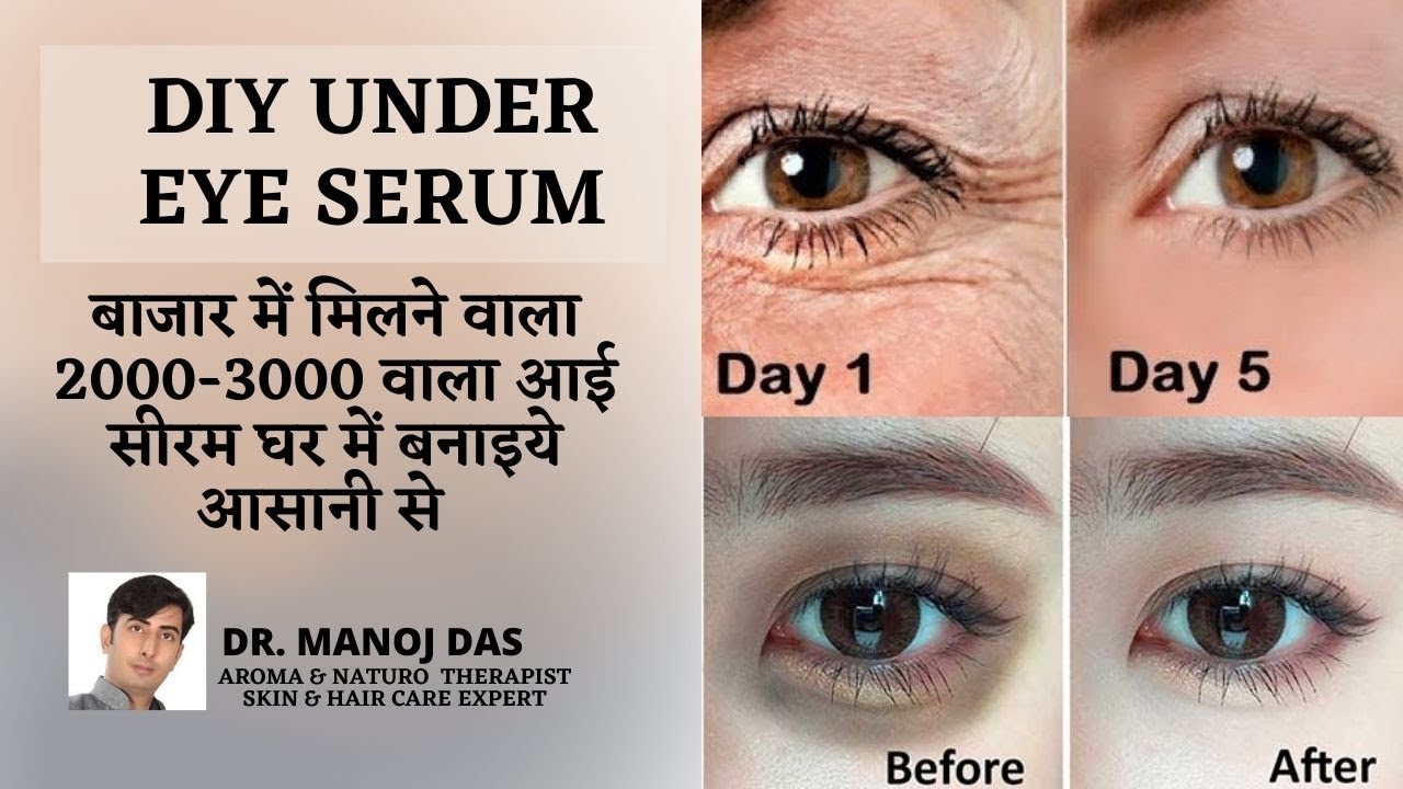 DIY for DARK CIRCLES, WRINKLES & PUFFINESS | Most Affordable & Results in 2 Weeks I DR. MANOJ DAS