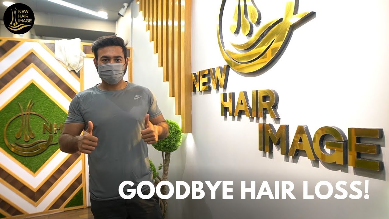 Hair Patches for men in Pakistan | GOOD BYE HAIR LOSS!