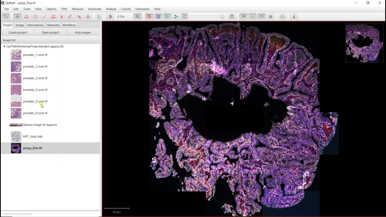 Visualization of fluorescence images with QuPath