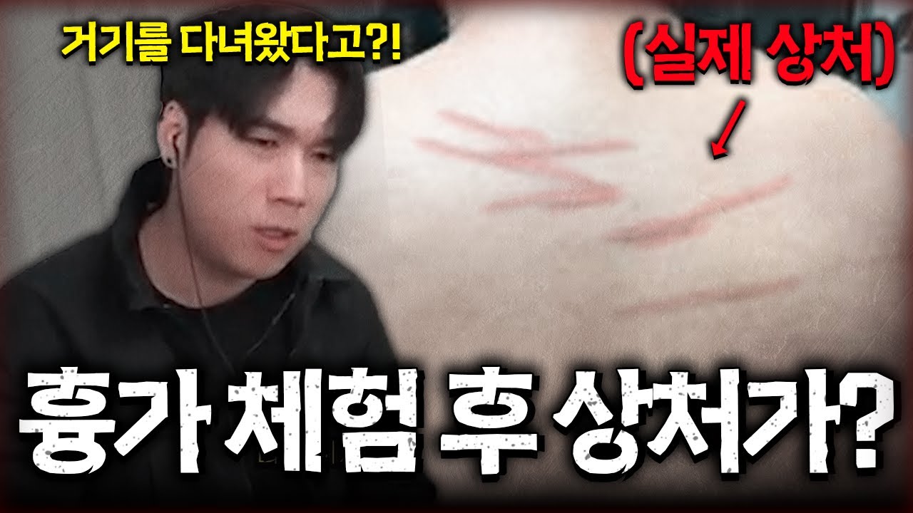 흉가 체험 후 상처가 생겼다는 다급한 제보 🏠👻구미의 집 EP.1 [당신의 집에 귀신이 산다 사연]