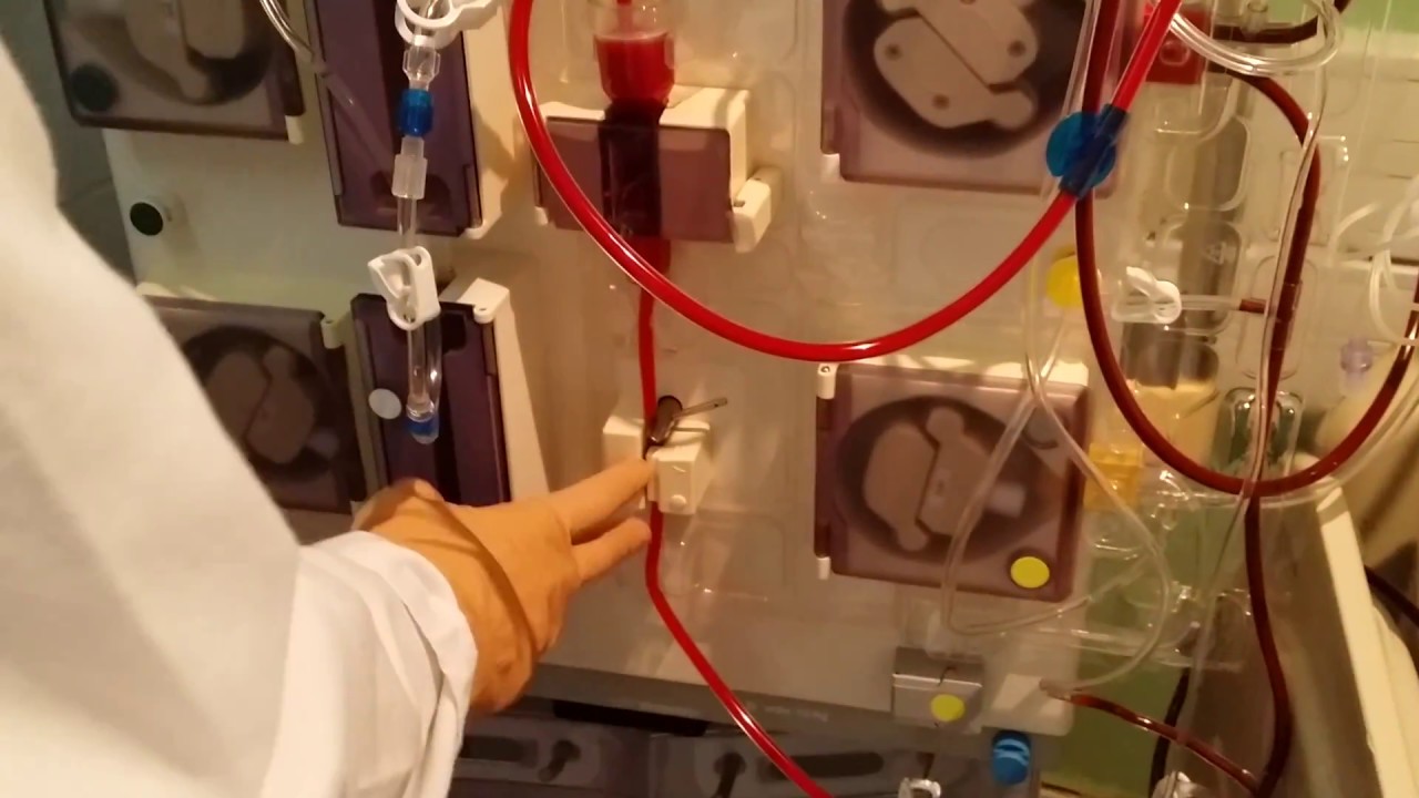 Plasmaféresis procedimiento. Conexión del paciente 2/4