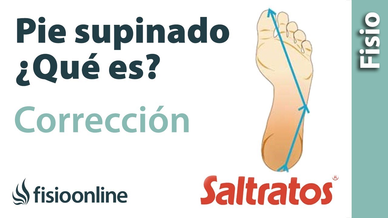 Pie supinado o supinador - Qué es, causas y corrección