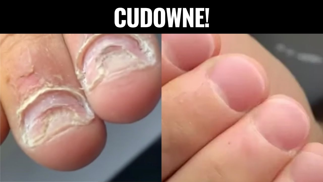 CUDOWNA METAMORFOZA OBGRYZIONYCH PAZNOKCI | Quloo Shoty #184