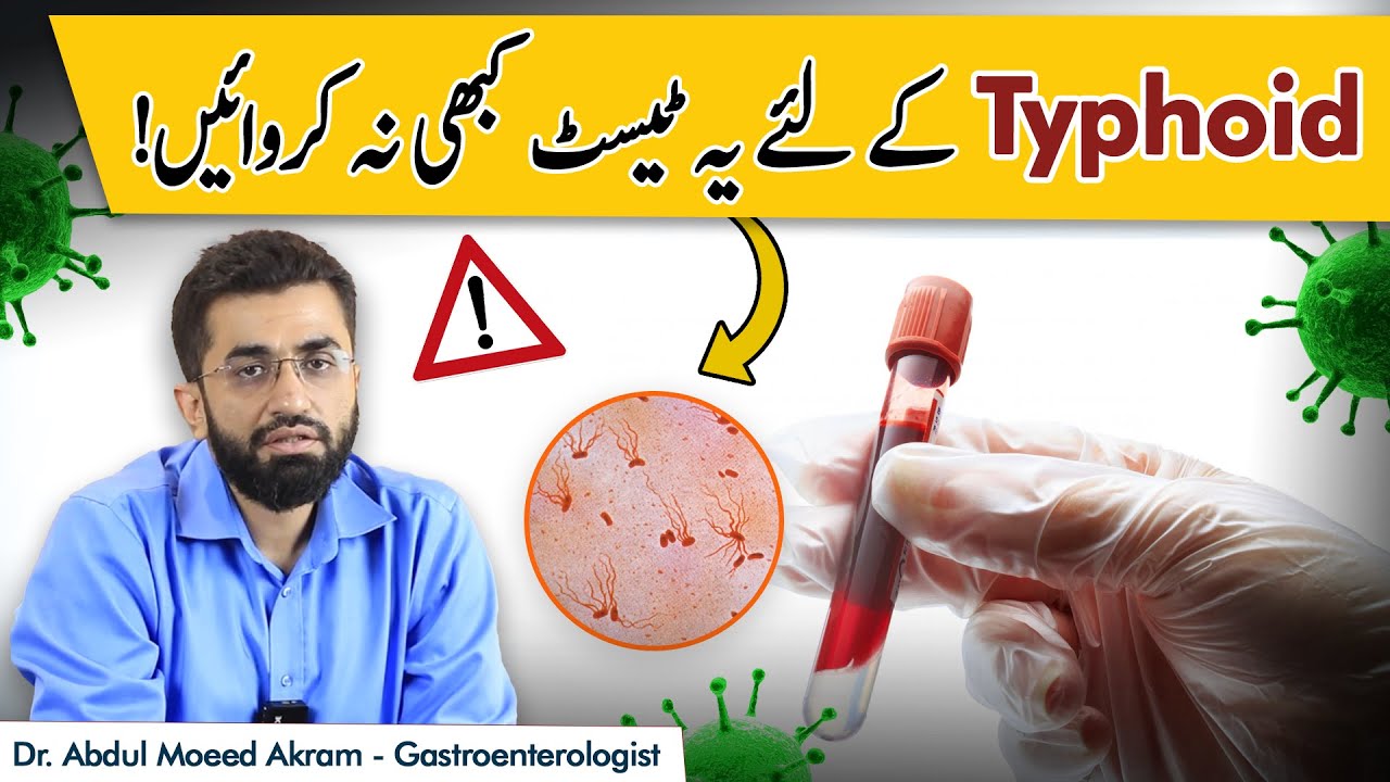 Right Test For Typhoid | Typhoid Mein Konsa Test Karwana Chahie