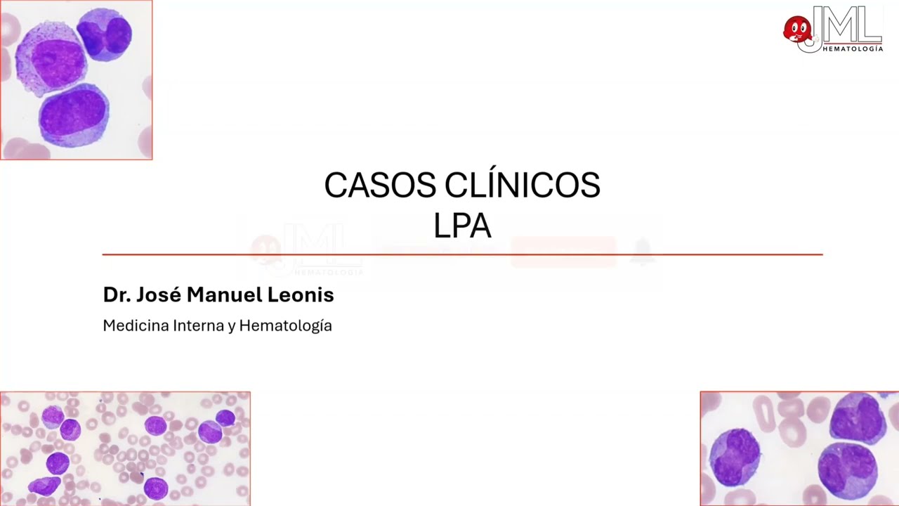 LPA (Leucemia Promielocitica Aguda). Morfología  e interpretación del hemograma.