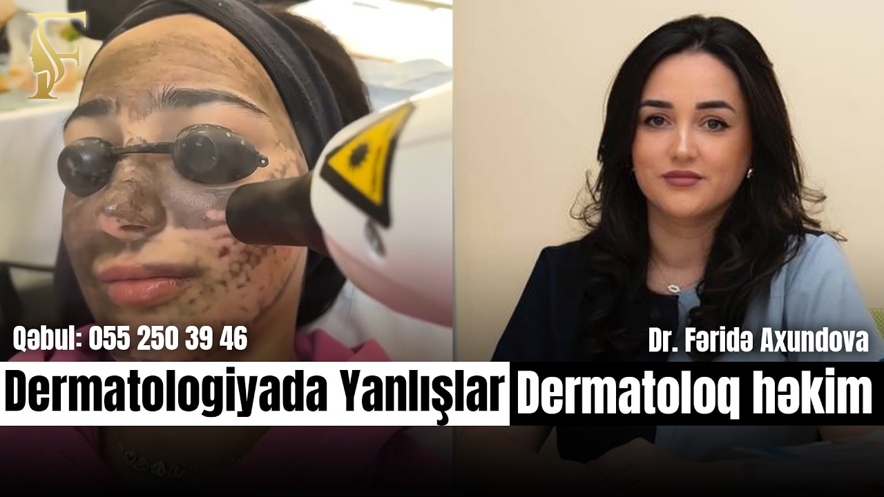Karbon Peeling Proseduru Dəridə Necə Təsir Göstərir?