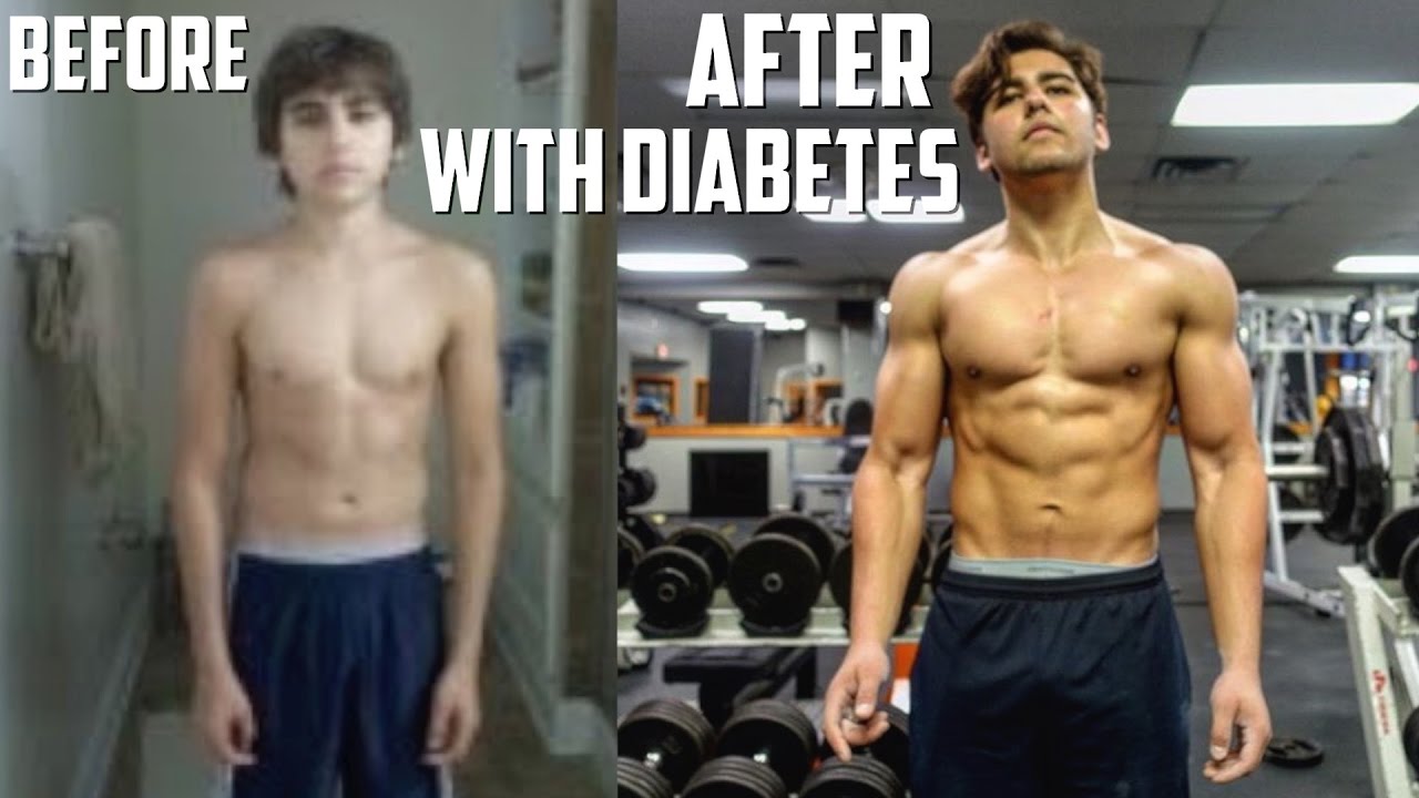 Type 1 Diabetic Bodybuilder Defeats His Disease | MY STORY