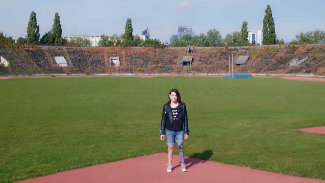 Poddała się amputacji, aby polepszyć komfort swojego życia [Usłyszcie nas!]