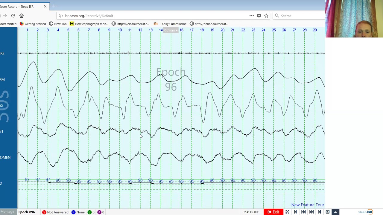 tips for respiratory scoring